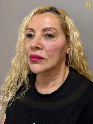 Foto antes e depois