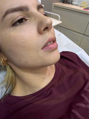 Foto antes e depois