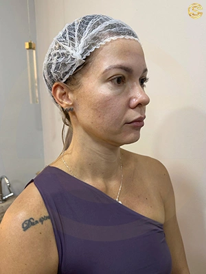 Foto antes e depois