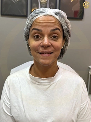 Foto antes e depois