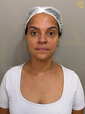 Foto antes e depois