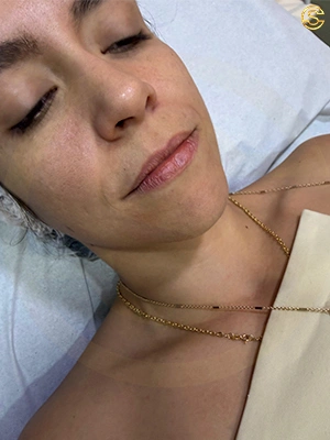 Foto antes e depois