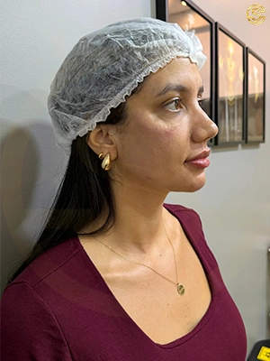 Foto antes e depois