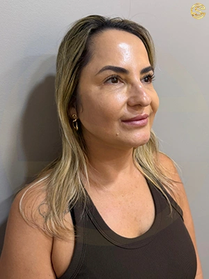 Foto antes e depois
