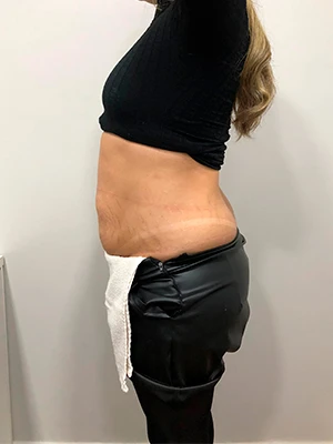 Foto antes e depois