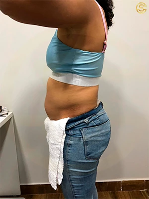 Foto antes e depois
