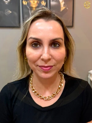 Foto antes e depois